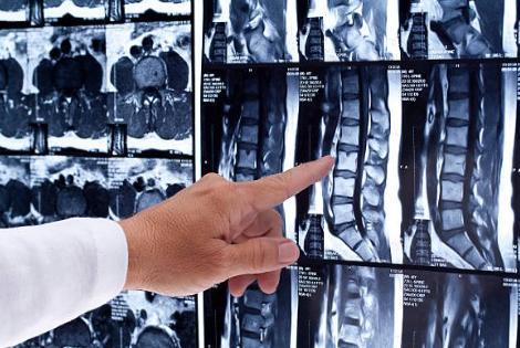 spinal cord injury lawyers December 2